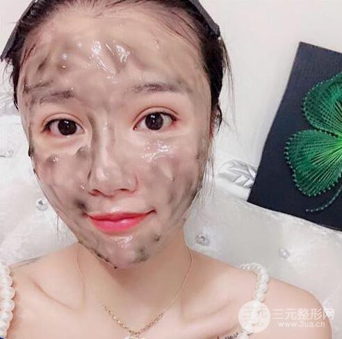 辣媽做了自體脂肪填充全臉，對(duì)比圖分享