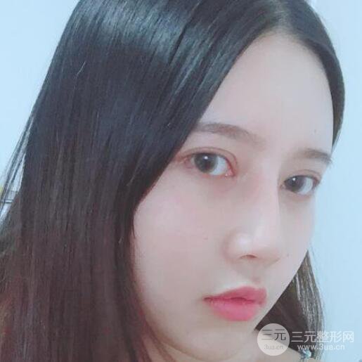 宜昌美岸醫(yī)療美容李英華自體脂肪面部填充怎么樣？真人日記曝光