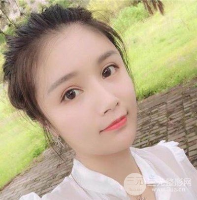 辣媽做了自體脂肪填充全臉，對(duì)比圖分享