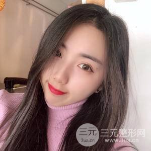 自體脂肪填充全臉恢復(fù)記錄