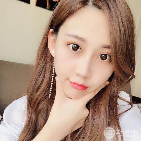 割雙眼皮兩個月是啥樣，妹子公開恢復(fù)記錄
