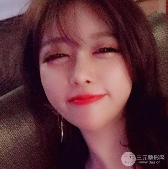 減肥太辛苦了，我還是做個(gè)面部吸脂來逆襲