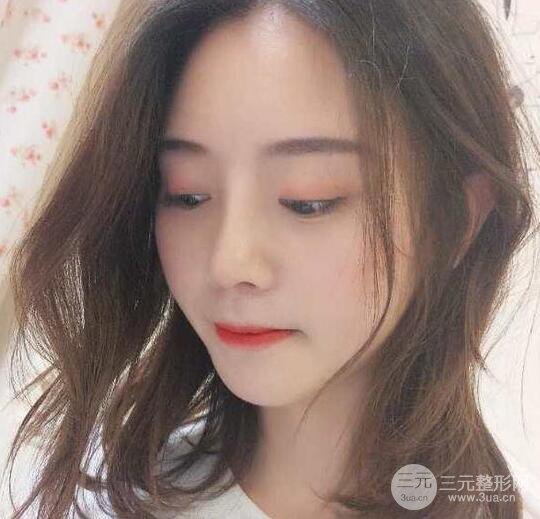 自體軟骨隆鼻恢復(fù)記錄，附對(duì)比圖片