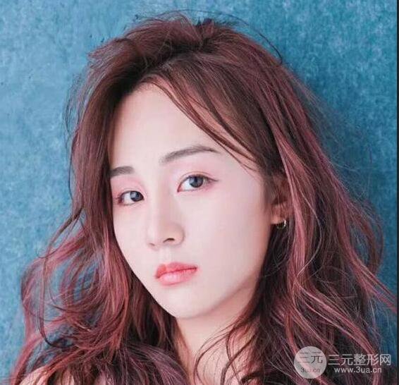 洛陽愛尚醫(yī)療美容王廷金隆鼻整形果圖，恢復(fù)后有點像張鈞甯