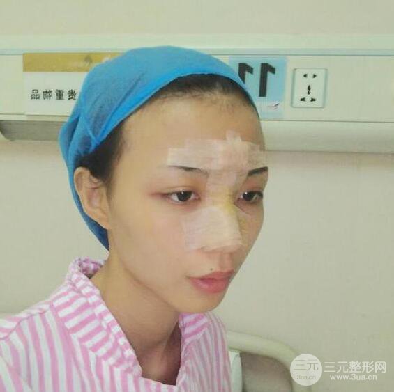 銀川崔大夫博士麗朱杰硅膠隆鼻恢復(fù)圖，輕松get精致臉