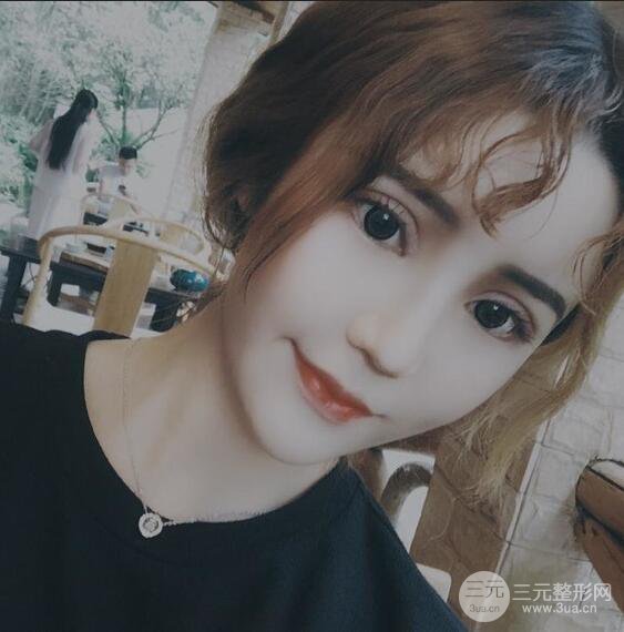 原來我和baby的距離只差一個網(wǎng)紅套餐，“雙眼皮+自體脂肪填充+豐唇”術(shù)后真人反饋