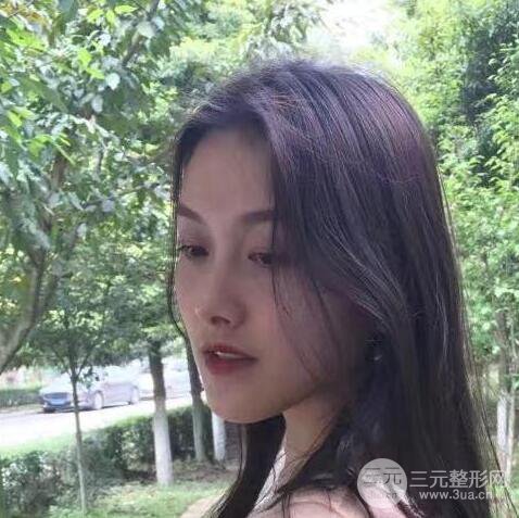 做了“埋埋蛋白線.提升+隆鼻整形”，恢復后老公說很沒有降低風險感