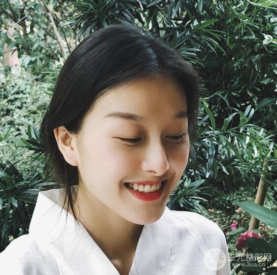 做了“埋埋蛋白線.提升+隆鼻整形”，恢復后老公說很沒有降低風險感