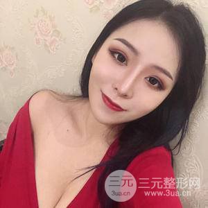 假體隆胸三個月恢復圖