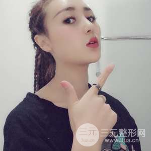進(jìn)口假體+肋軟骨墊鼻尖三個(gè)月果恢復(fù)對比圖