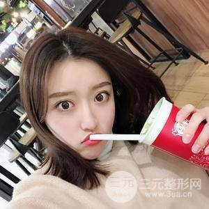 面部吸脂100天恢復(fù)果對比圖