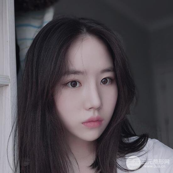 上海華美醫(yī)療美容李庭勛膨體隆鼻怎么樣？果對比圖