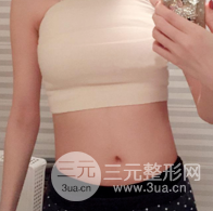 自體脂肪隆胸恢復(fù)圖曝光，見證從A到C的蛻變