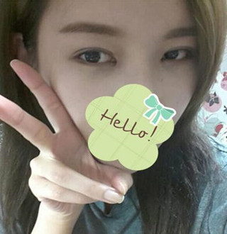 一起來(lái)評(píng)價(jià)一下重慶愛(ài)思特盧剛醫(yī)生做的切開(kāi)雙眼皮吧