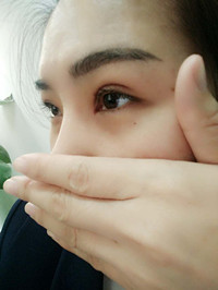 于利民醫(yī)生讓我基本和單眼皮說(shuō)“拜拜”