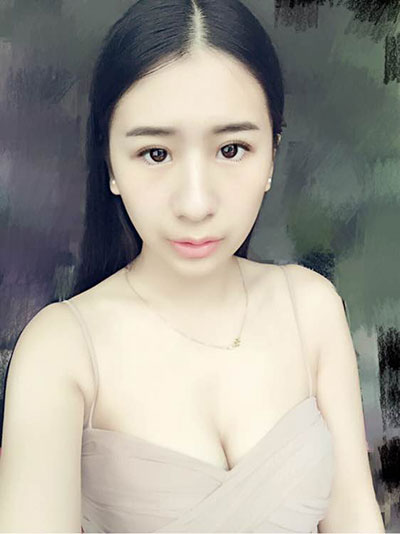 大家看看盧剛給我做的膨體墊下巴怎么樣