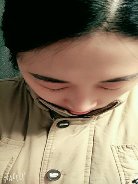 于立民醫(yī)生給我做的隆鼻整形手術(shù)，給大家分享我整形的過(guò)程吧!