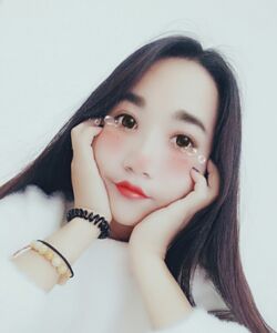 煙臺(tái)鵬愛(ài)魏璐做的全切雙眼皮，我也是大眼美女了