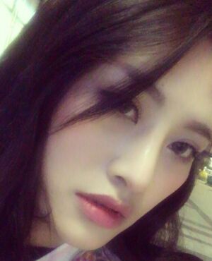 趙煜楠給做的隆鼻整形，看看我鼻子果怎么樣