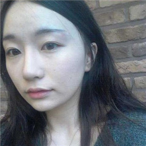 趙雅雄做下頜角整形成好嗎？看看我的前后對(duì)比圖片就知道了~