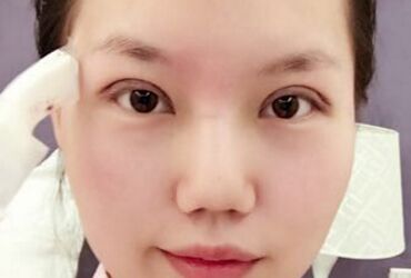 雙眼皮讓我眼睛變得更大更漂亮啦