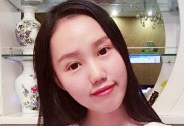 雙眼皮讓我眼睛變得更大更漂亮啦