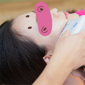 黃慶武醫(yī)生做的音波拉皮除皺手術(shù)分享，有很多前后對(duì)比果圖片哦~~~