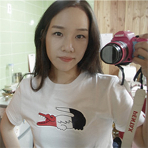 去年在格萊美做了頭發(fā)種植，看看前后對(duì)比和恢復(fù)果照片吧~~