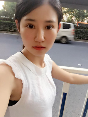 看了顏玲做的雙眼皮多項(xiàng)整形 你們心動(dòng)了沒(méi)