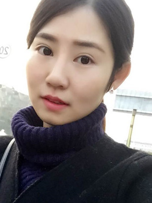 看了顏玲做的雙眼皮多項(xiàng)整形 你們心動(dòng)了沒(méi)