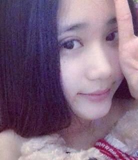 北京常好麗格割雙眼皮一周啦~