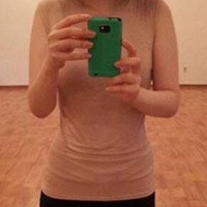 北京常好麗格腰腹吸脂后20天的感受 恢復(fù)日記來(lái)咯~