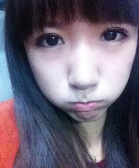 北京常好麗格三點(diǎn)定位雙眼皮恢復(fù)一個(gè)月經(jīng)歷