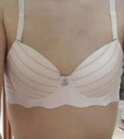 北京常好麗格三點(diǎn)定位雙眼皮恢復(fù)一個(gè)月經(jīng)歷