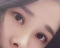 切開雙眼皮價格2680元，費用不貴果卻很好