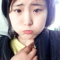 給大家看看我做的切開雙眼皮+開眼角恢復(fù)全過程很漂亮哦