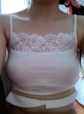 275CC麥格假體隆胸后身材變得超棒了