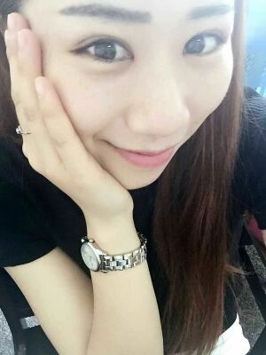 做了全切雙眼皮和開內(nèi)眼角，術(shù)后果較為滿意