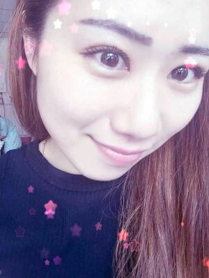 做了全切雙眼皮和開內(nèi)眼角，術(shù)后果較為滿意