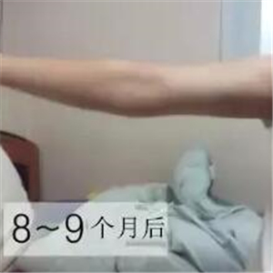 手臂吸脂手術(shù)八個(gè)月了，看看我的前后對(duì)比果圖片吧~~