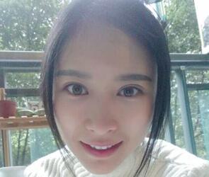 自體脂肪面部填充三個(gè)月了,恢復(fù)的很好,給你們看看果怎么樣吧,是不是很美麗了~