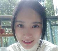 大腿吸脂做自體脂肪面部填充三個(gè)月了，分享給大家