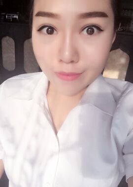 終于把雙眼皮割了，無錫菲尚張樹功做的