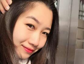 自體脂肪臉部填充臉部輪廓更協(xié)調(diào)