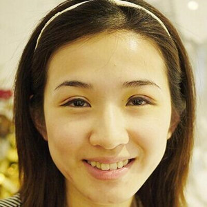 雙眼皮手術(shù)前后過程以及真實案例分享