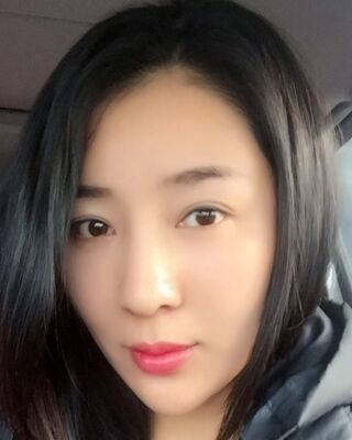 埋埋蛋白線.提升整個面部年輕很多，小V臉也出來了