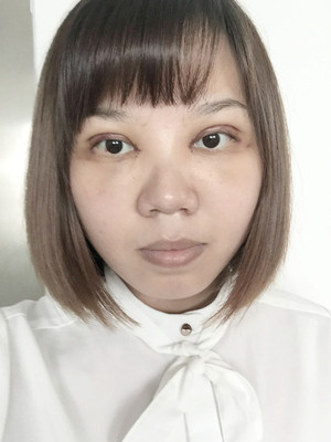 做了雙眼皮多項(xiàng)整形手術(shù)，大家來看看果如何