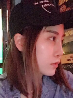 不想再打玻尿酸就去做了硅膠假體隆鼻