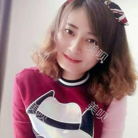 玻尿酸墊下巴后改變了我的大餅?zāi)樄镣淄椎? /> </a>
</div>
</dd>
</dl><dl>
<dt>
<a href=