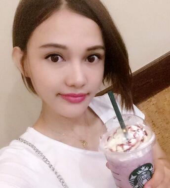 玻尿酸豐太陽(yáng)7天果圖 愛(ài)悅麗格豐太陽(yáng)穴一個(gè)月啦~